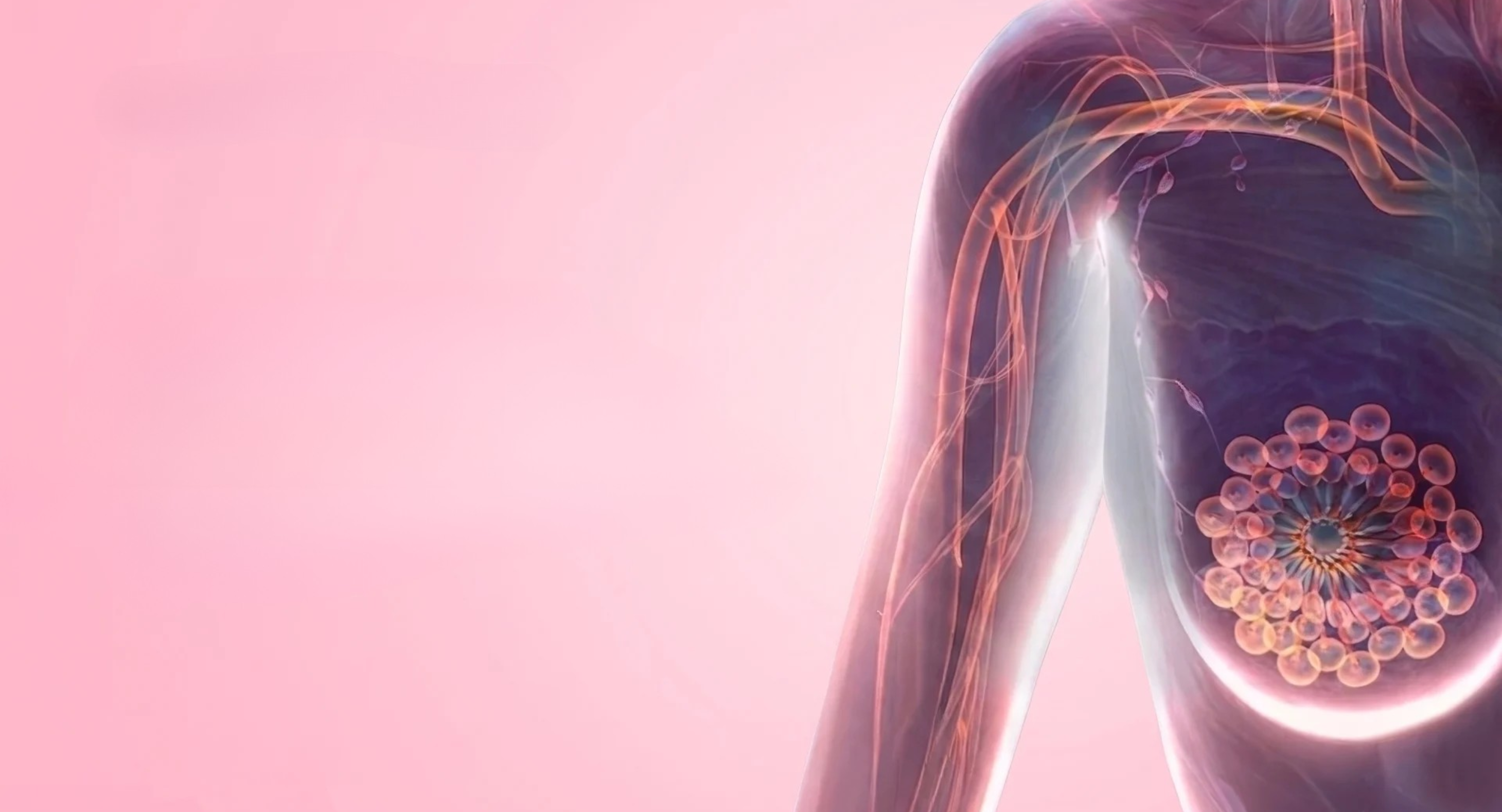Adcs earlier treatment implications — cancer awareness article by Dr. Nishith Vaddeboina, Medical Oncologist in Hyderabad
