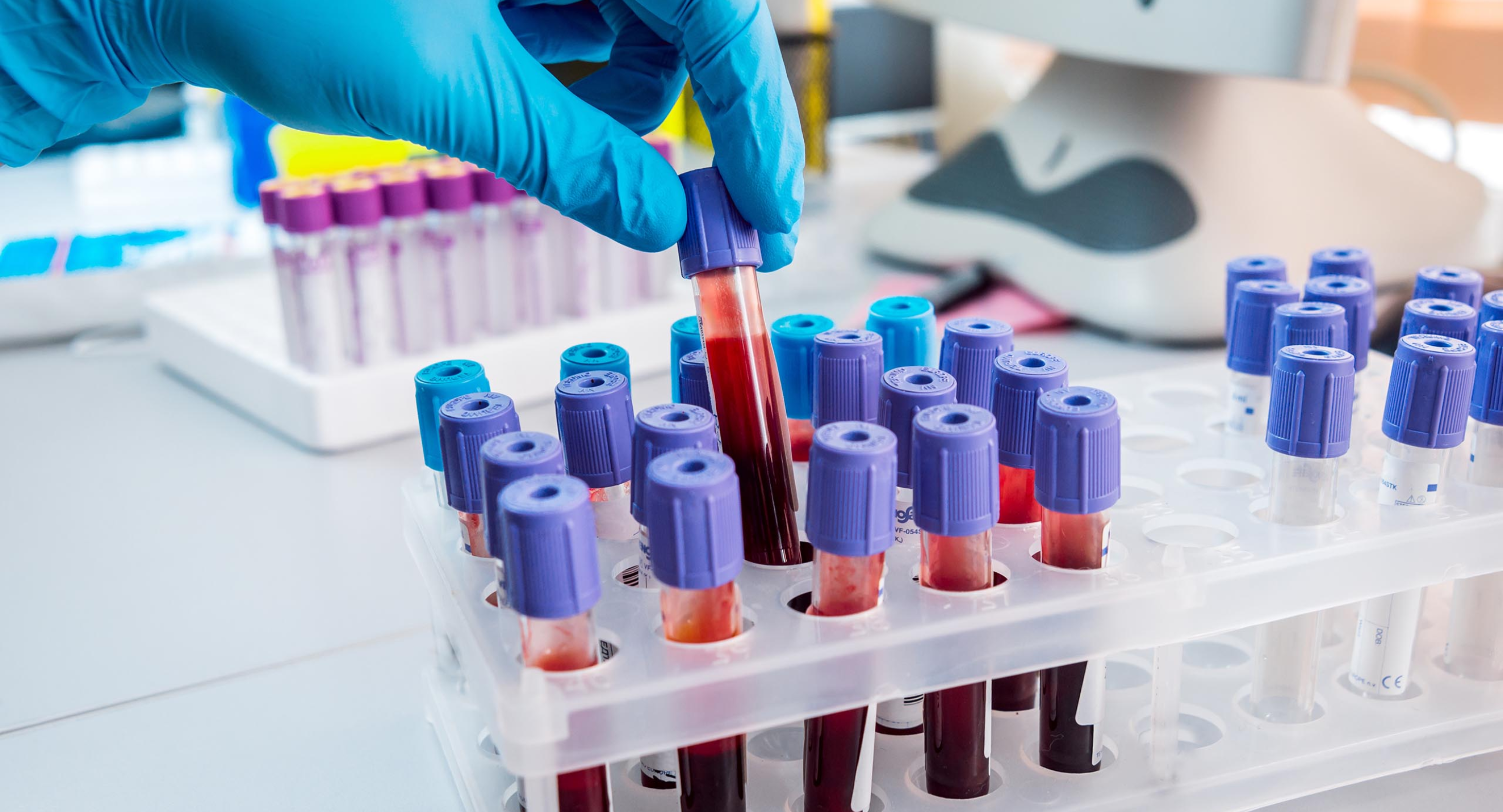 Biomarker testing cancer guide 2026 — cancer awareness article by Dr. Nishith Vaddeboina, Medical Oncologist in Hyderabad