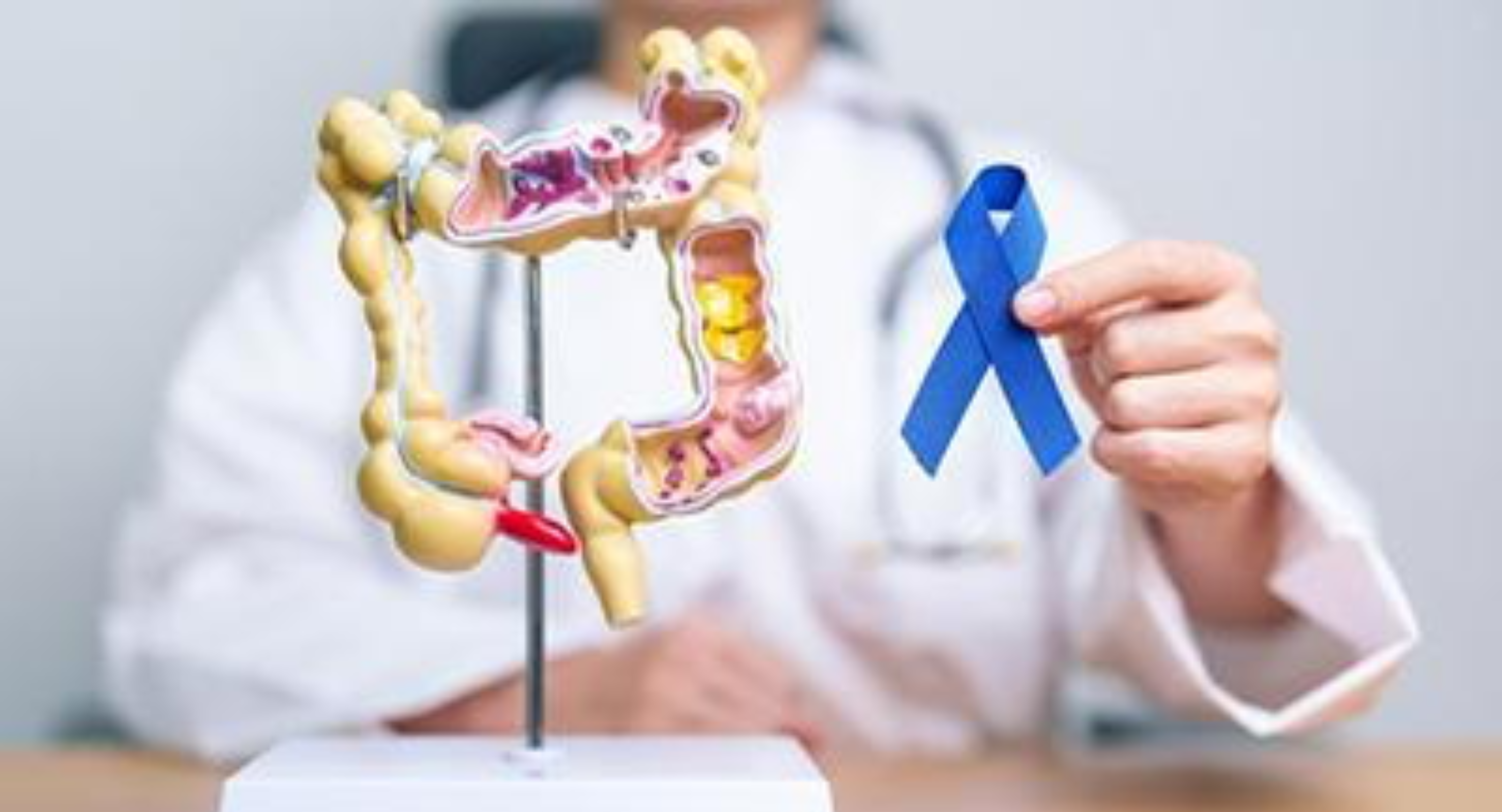 Colorectal cancer awareness guide — cancer awareness article by Dr. Nishith Vaddeboina, Medical Oncologist in Hyderabad